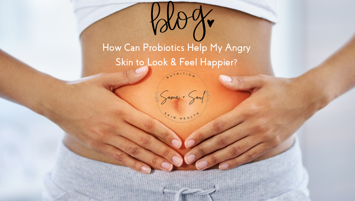 How Can Probiotics Help My Angry Skin to Look and Feel Happier?