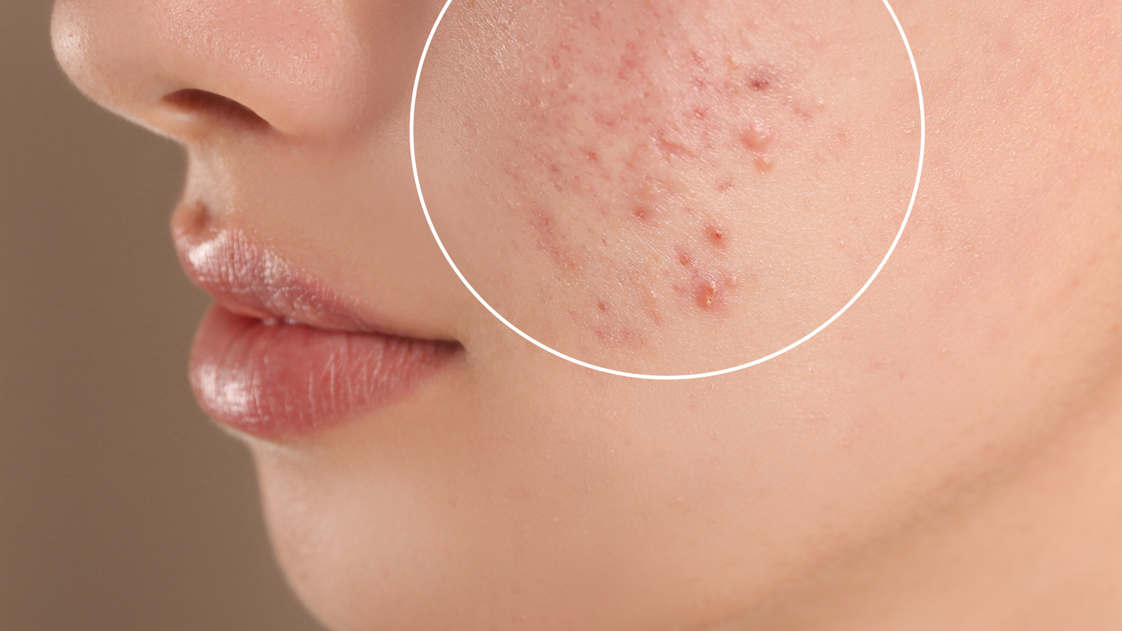 Back to School Confidence Body Odour Acne Natural Skincare