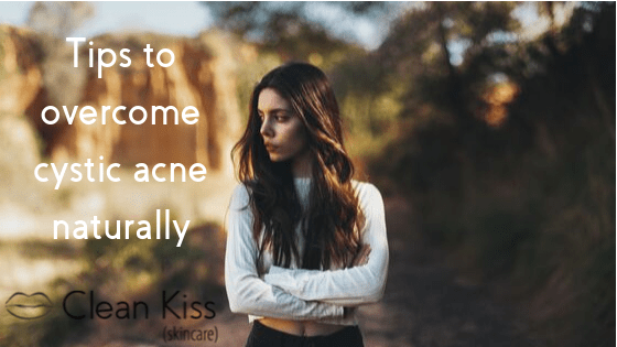 Tips to Help You Overcome Cystic Acne, Naturally  - Updated 2020