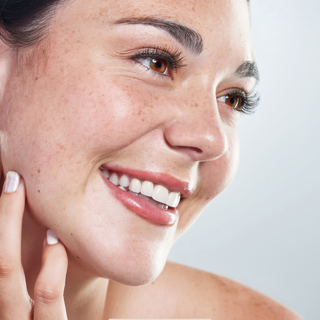 Kiss Those Spots Goodbye 4-Piece Acne Set